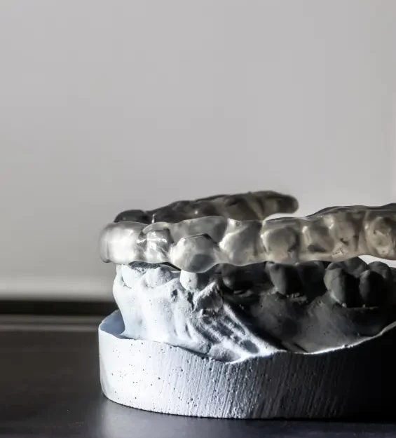 bruxismo-tratamiento-facial-clinica-dental-servans-ciudad-lineal-madrid
