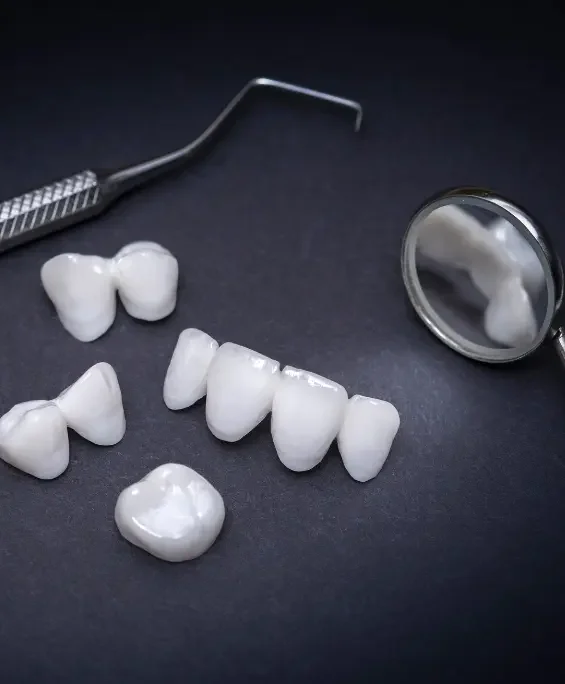 Carillas dentales para estética dental en Clínica Dental Servans, Ciudad Lineal, Madrid.