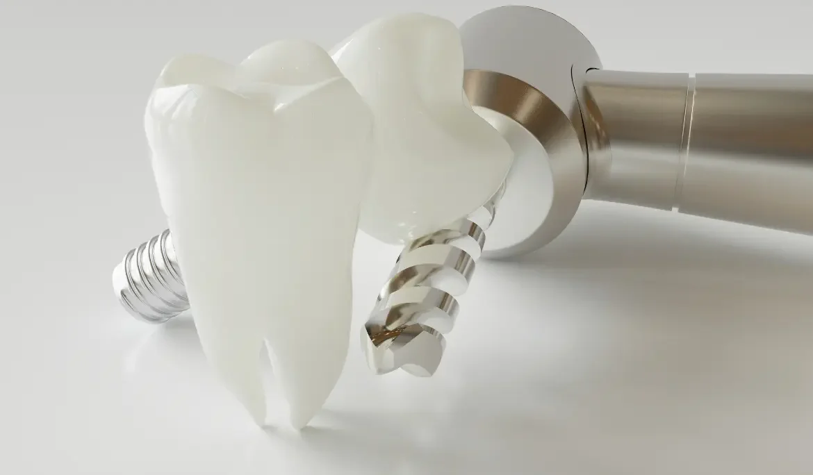 Tratamiento de implantes dentales en Clínica Dental Servans, Ciudad Lineal, Madrid.