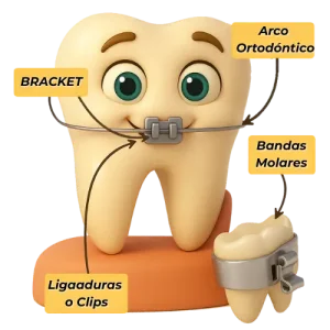 brackets-clinic-dental-servans-ciudad-lineal-3